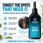 PsoriAid Scalp Serum - Target the spots that need it